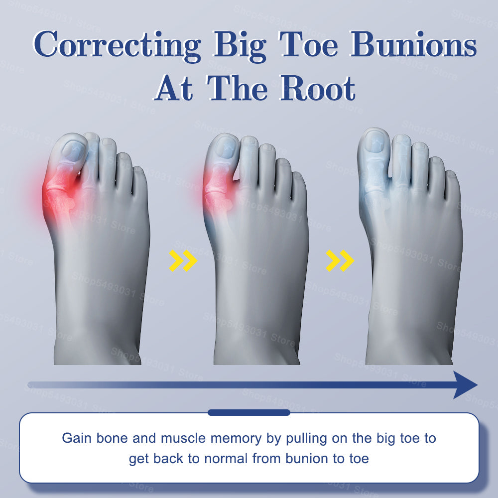Premium Adjustable Bunion Corrector | Hallux Valgus Straightener with Rotatable Toe Separator, Soft Silicone Pad, Flexible 