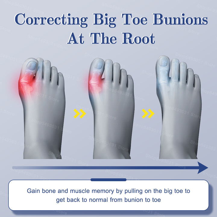 Premium Adjustable Bunion Corrector - Hallux Valgus Toe Straightener with Orthopedic Splint, Rotatable Toe Separator for Pain