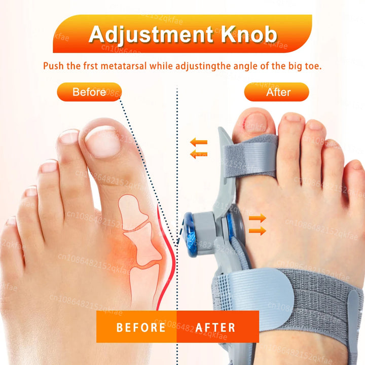 Premium verstellbarer Hallux Valgus Korrektor – Großzehenbegradiger mit orthopädischer Ballenstütze, Silikonpolster und Zehenseparator zur Schmerzlinderung und Zeigenausrichtung, flexible Größe für Männer und Frauen