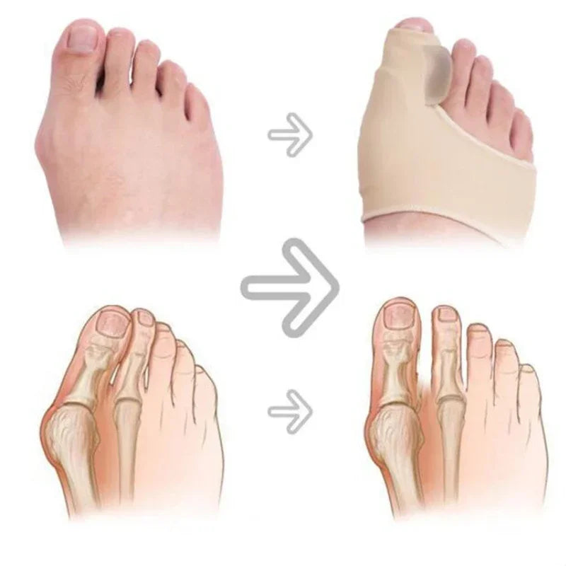 Premium Bunion Corrector Toe Separator - 2Pcs Hallux Valgus Orthotics, Soft Gel Comfort, Adjustable Fabric, Pain Relief for 