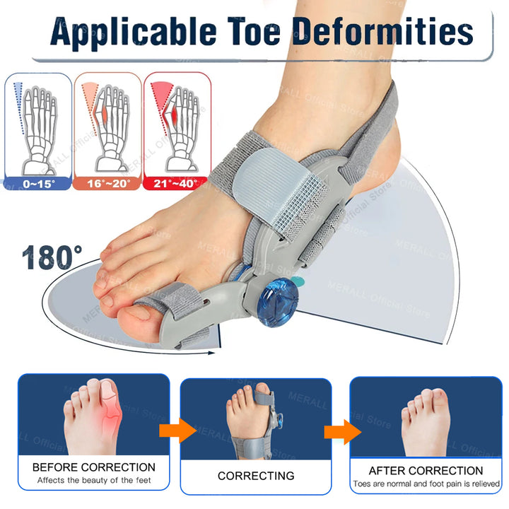 Premium Adjustable Bunion Corrector - Hallux Valgus Toe Straightener with Orthopedic Splint, Rotatable Toe Separator for Pain