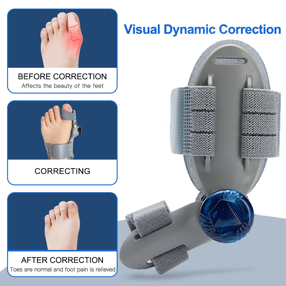 Premium Adjustable Bunion Corrector | Hallux Valgus Straightener with Rotatable Toe Separator, Soft Silicone Pad, Flexible 