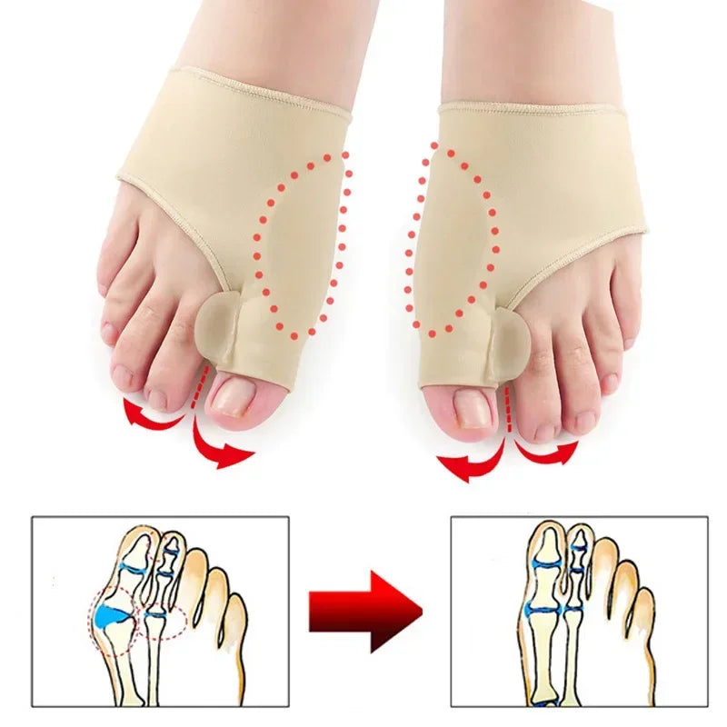 Premium Bunion Corrector Toe Separator - 2Pcs Hallux Valgus Orthotics, Soft Gel Comfort, Adjustable Fabric, Pain Relief for 